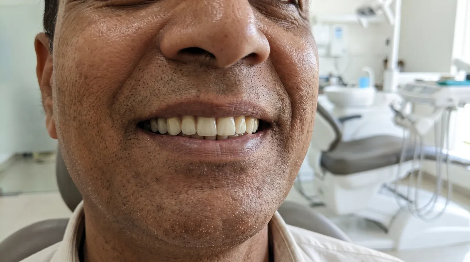 Natural-looking smile after a dental implant procedure