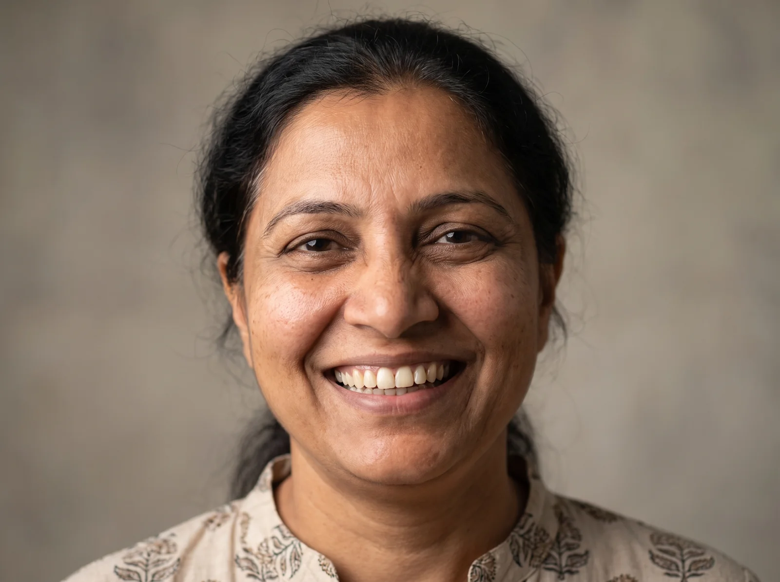 Complete natural smile after a dental implant in Mehsana