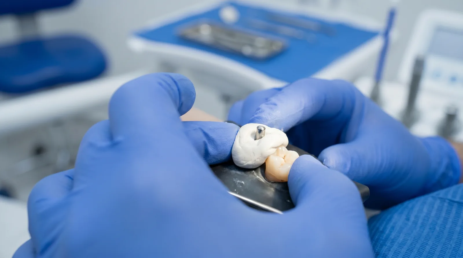 Composite core build-up rebuilding the tooth