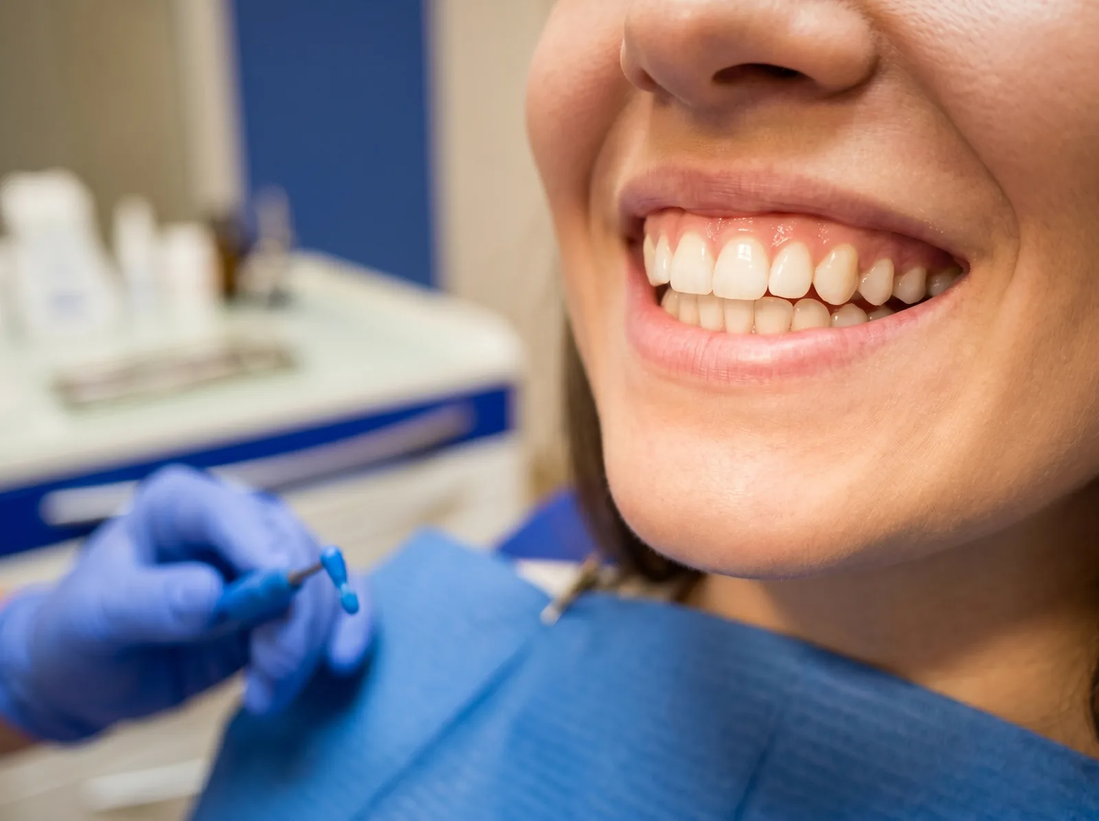 Brighter smile after professional teeth whitening session